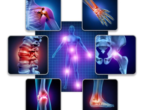 Effects of Hyperbaric Oxygen Therapy on Inflammation, Oxidative/Antioxidant Balance, and Muscle Damage After Acute Exercise